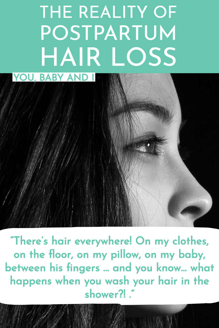 The Reality of Postpartum Hair Loss